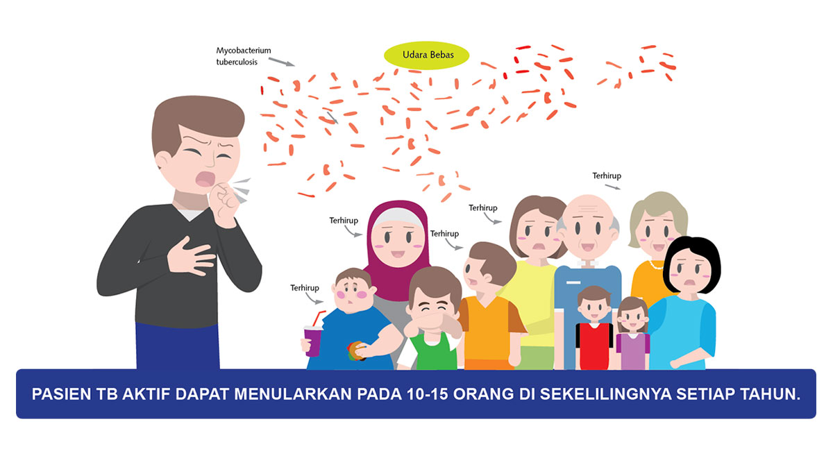 Cara Penularan Penyakit Tuberkulosis Tbc Yang Wajib D