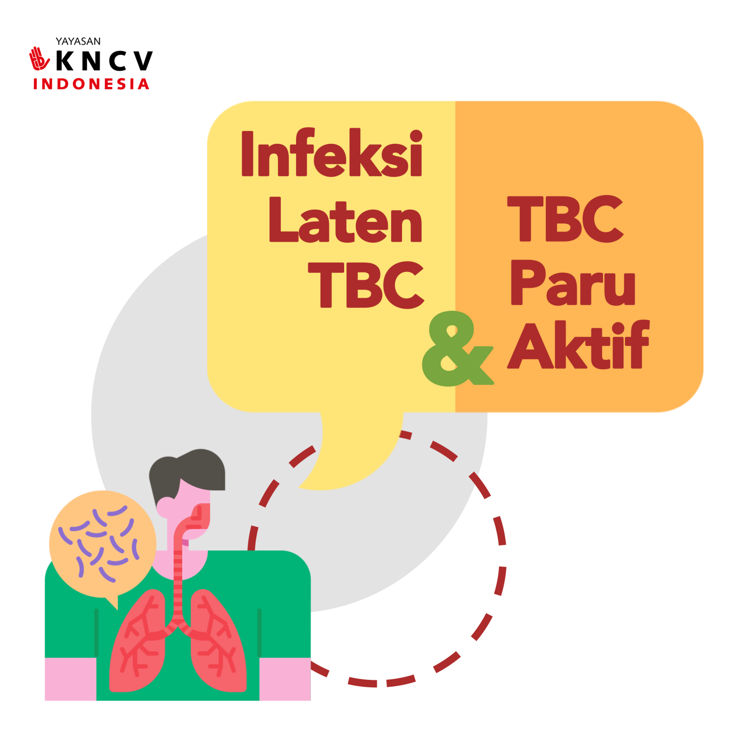 Infeksi Laten Tuberkulosis Dan Tuberkulosis Paru Aktif | Yayasan KNCV ...