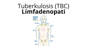 TBC Limfadenopati