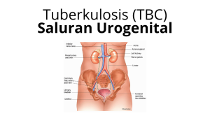 TBC Saluran Urogenital